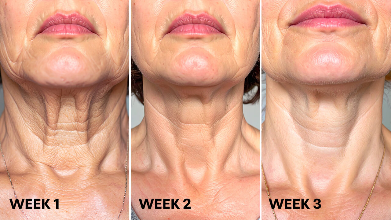 3cream-spd-body-image